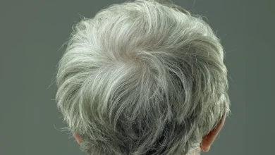 O que cabelos grisalhos podem indicar sobre o risco de câncer de pele, segundo pesquisas