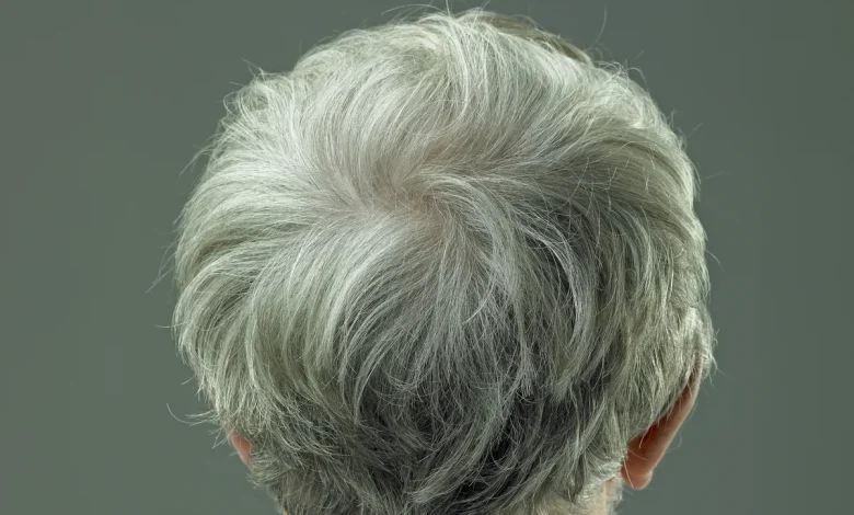 O que cabelos grisalhos podem indicar sobre o risco de câncer de pele, segundo pesquisas