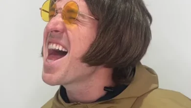 As Oasis reunites, Liam has captured the attention of fans around the world – but we aren't talking about Liam Gallagher