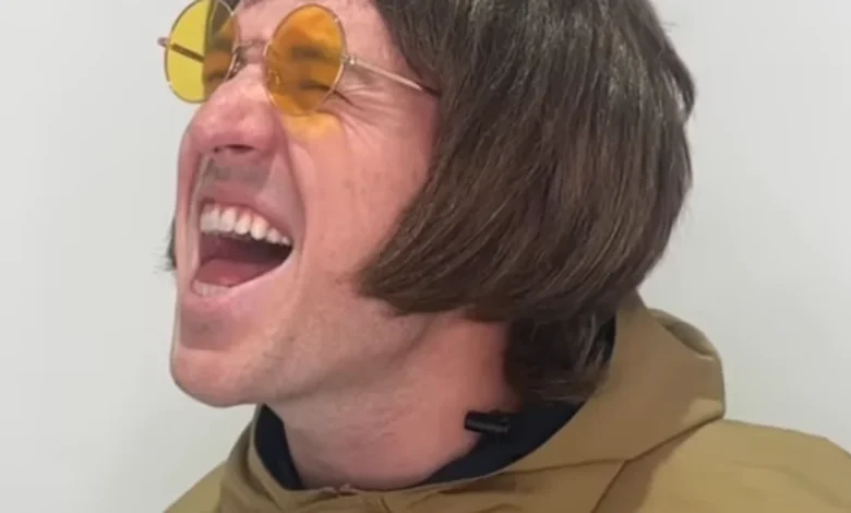 As Oasis reunites, Liam has captured the attention of fans around the world – but we aren't talking about Liam Gallagher