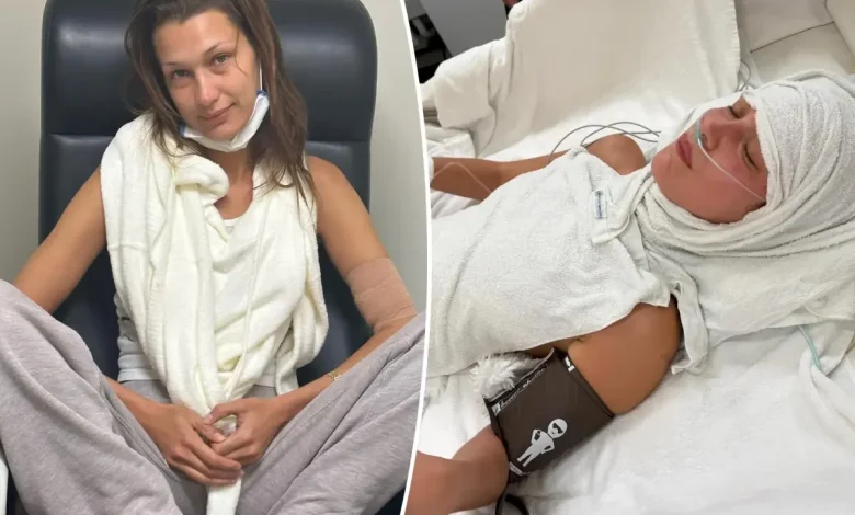 Bella Hadid gets candid about suffering from ‘medical anxiety’ amid chronic Lyme disease battle