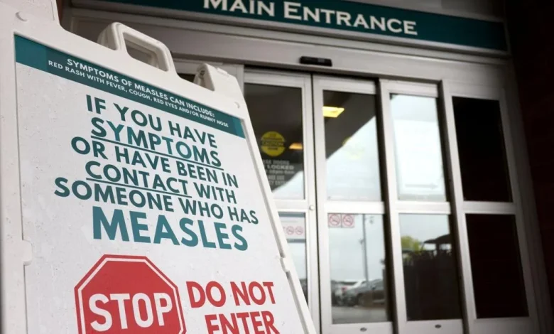 Canada has lost its measles elimination status