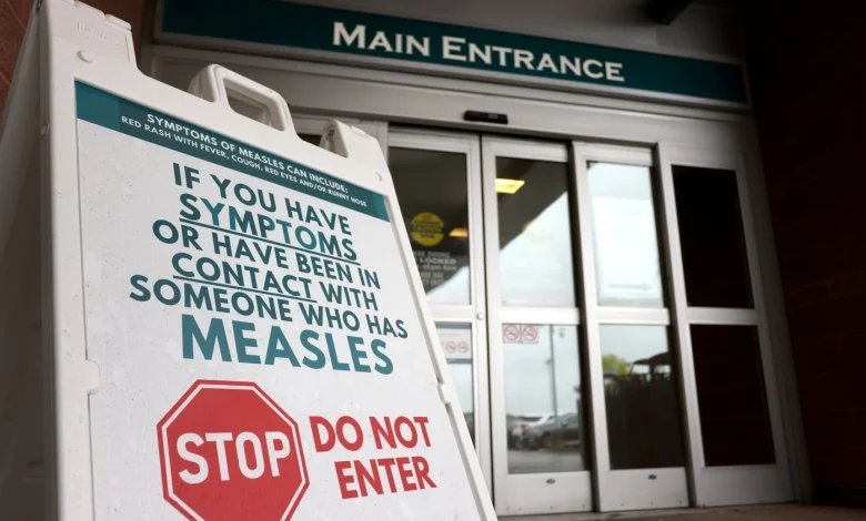 Canada has lost its measles elimination status after more than 25 years