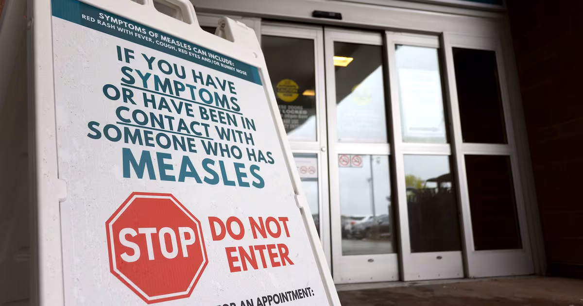 Canada has lost its measles elimination status, says Ottawa