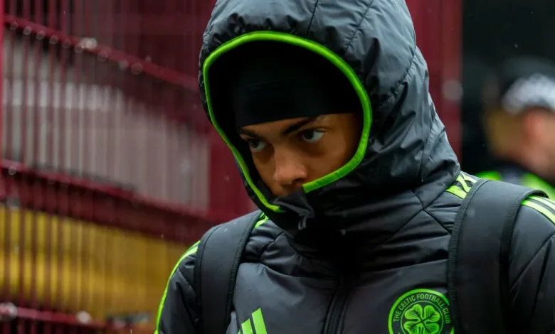 Celtic Hit By Surprise Absence