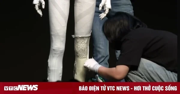 Çok gerçekçi görünen robot IRON'un derisi bunu kanıtlamak için 'kesildi'