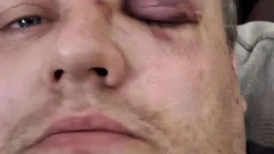 Delivery driver beaten up simply for ‘doing his job’ adopts bodycam as ‘deterrent’