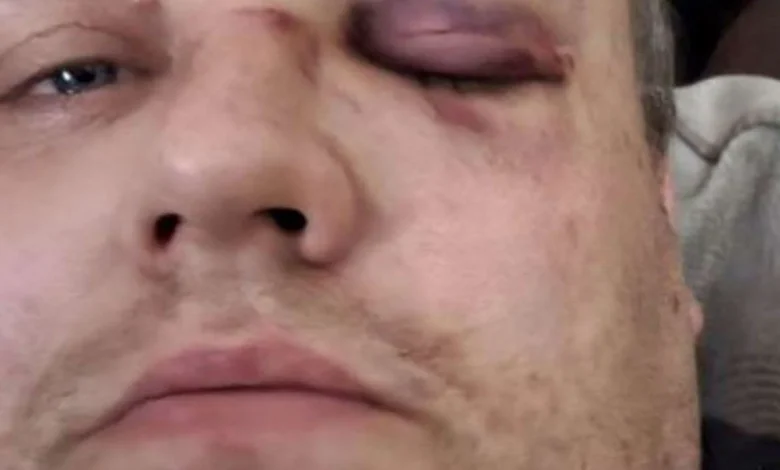 Delivery driver beaten up simply for ‘doing his job’ adopts bodycam as ‘deterrent’