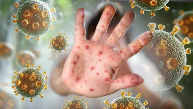 Department of Health unveil two new measles exposure sites in the South West