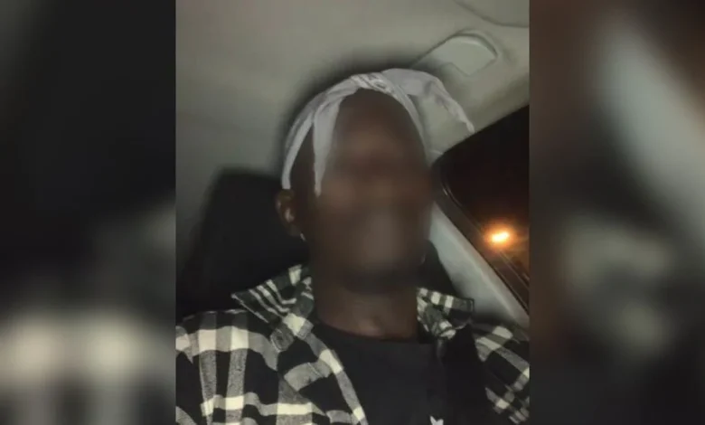 Derrière le casse du siècle au Louvre, le déconcertant « Doudou Cross Bitume », voleur présumé de la galerie d’Apollon