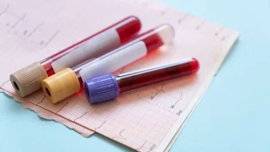 Hims & Hers Stock: The Growth Story Is Outside GLP-1s (NYSE:HIMS)