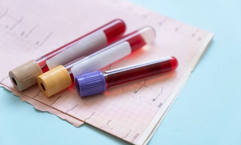 Hims & Hers Stock: The Growth Story Is Outside GLP-1s (NYSE:HIMS)