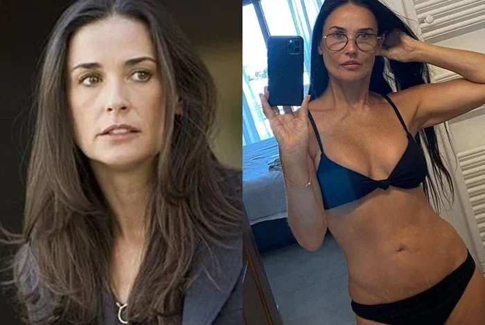 "KRW 700 Million Full-Body Surgery? The Truth Is..." Expert Offers Insight on 63-Year-Old Demi Moore
