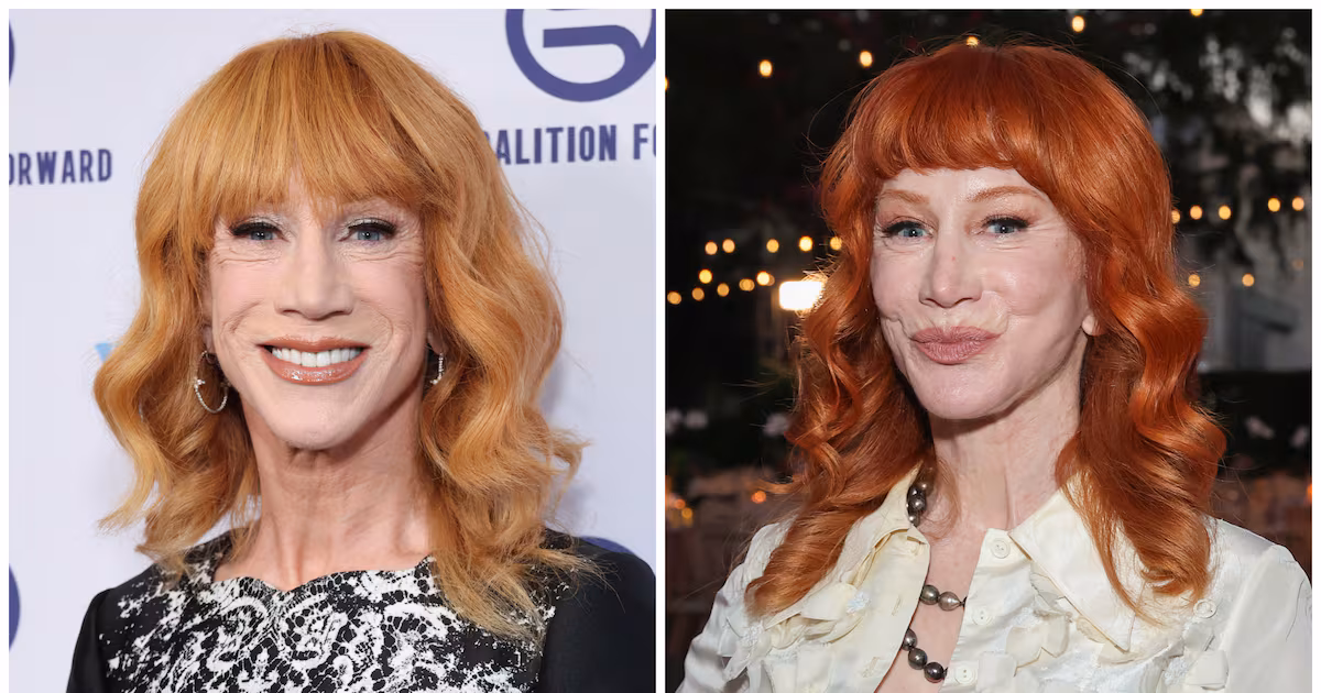 Kathy Griffin, 65, Says Third Facelift Came at a Shocking Price