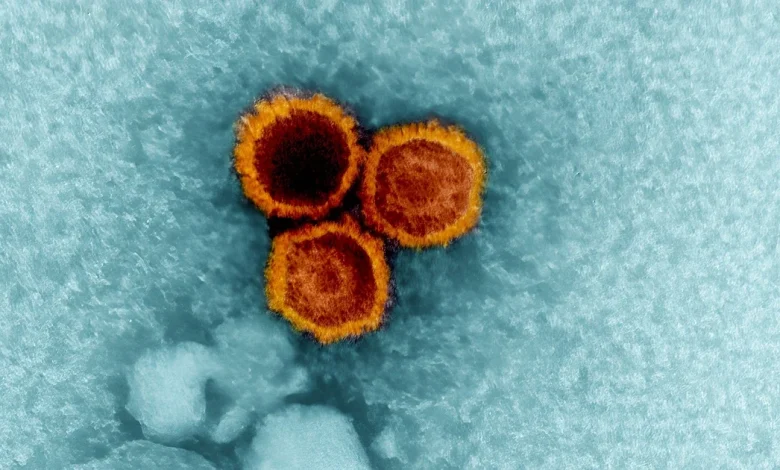 Lupus may be caused by the common Epstein-Barr virus, study finds