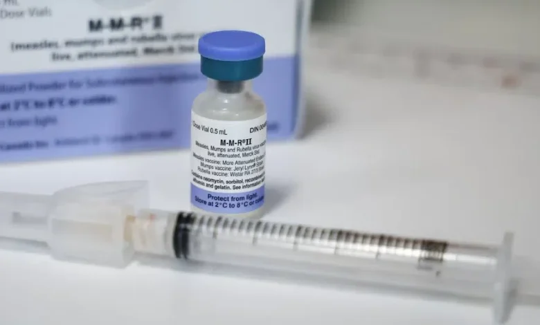 Measles cases confirmed in Saskatoon