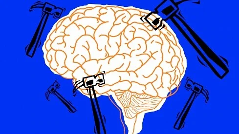 Not just a bad headache: Why migraine is world's second-most disabling condition