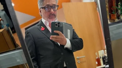 Nuno Markl hospitalizado depois de sofrer AVC