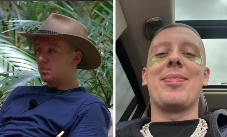 Omg, it turns out Aitch had a secret girlfriend before heading into the I’m A Celeb jungle
