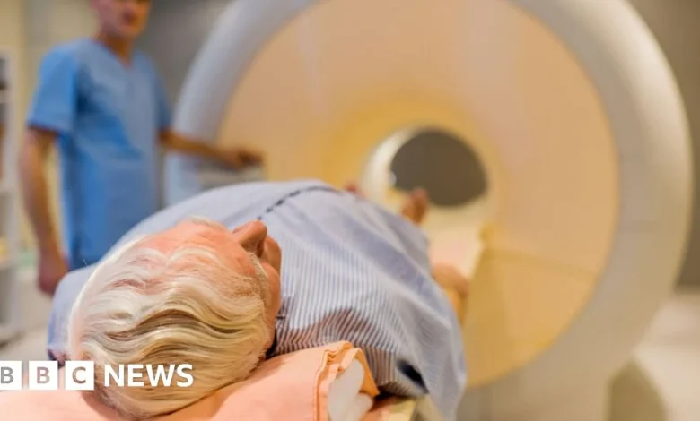 Prostate cancer screening trial to recruit thousands of men