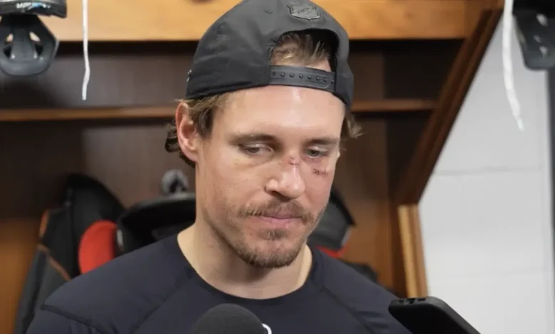 Senators Winger Nick Cousins And The NHL's Unofficial Frontier Justice System