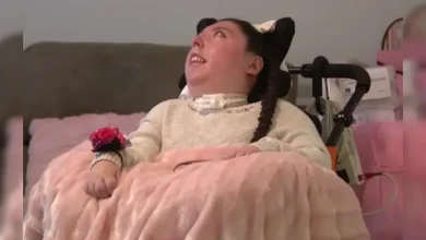 US Woman Born With No Brain Celebrates 20th Birthday, Doctors Said She Wouldn't Live Past 4