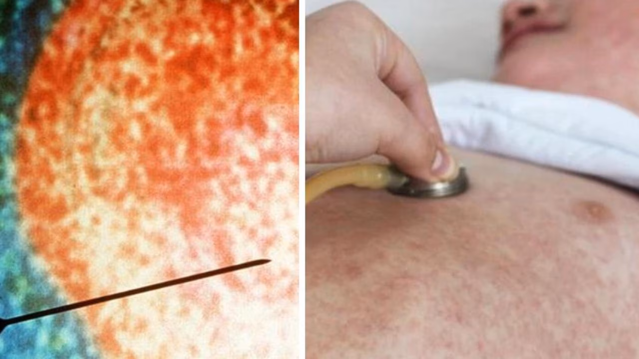 Urgent alert as disease outbreak grows