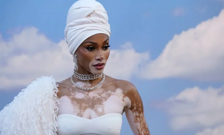 Winnie Harlow Responds After Whitney Houston Halloween Costume Sparks Backlash