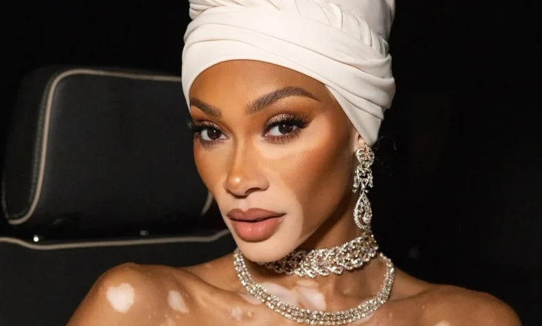 Winnie Harlow Sparks Outrage With Controversial Whitney Houston Skit 'You Betta Lay Low'