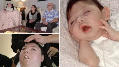 Woman born with no brain turns 20 in medical ‘miracle’ — told she’d never make it to 5