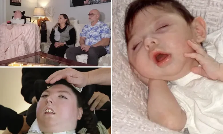 Woman born with no brain turns 20 in medical ‘miracle’ — told she’d never make it to 5