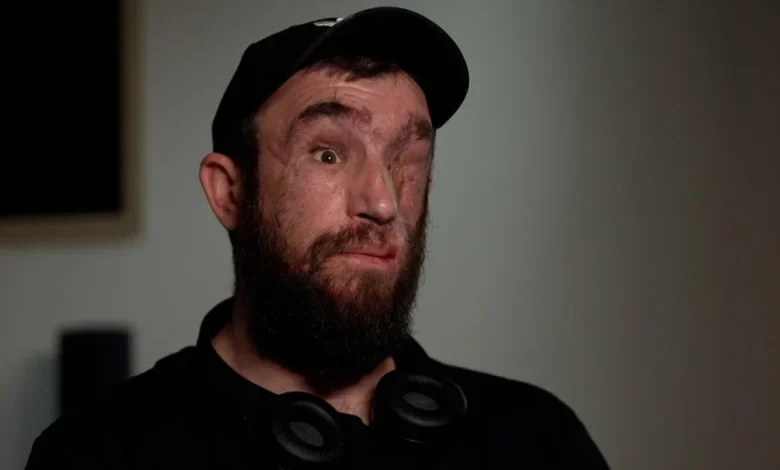 As Trump pushes Ukraine to give Russia land for peace, a wounded soldier asks, "How much more can we give?"