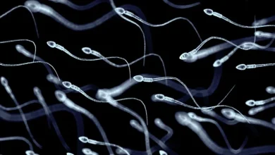 At least 197 children were fathered by sperm donor with cancer-causing gene. Some have already died
