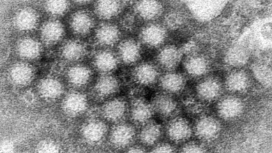 Cases of fast-moving stomach bug norovirus rise across U.S.