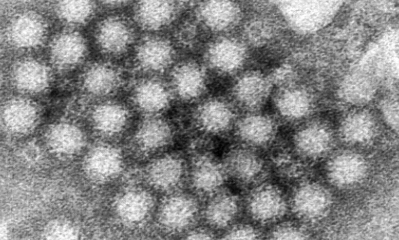 Cases of fast-moving stomach bug norovirus rise across U.S.