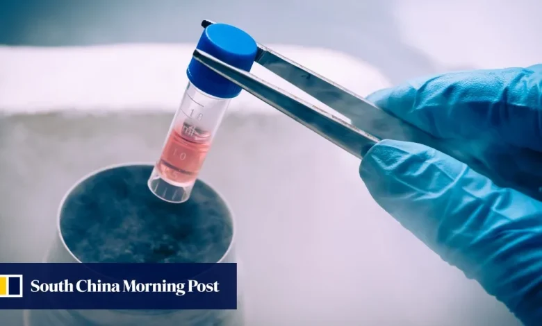 Chinese scientists develop promising stem cell therapy for Parkinson’s