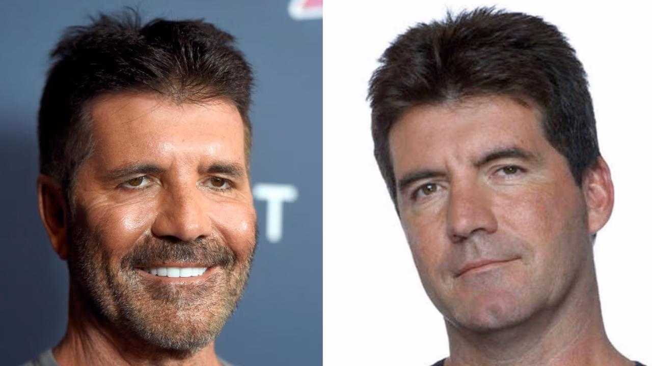 Cowell addresses dramatic changes to face