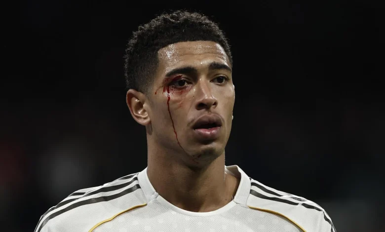 El Real Madrid se desangra en el Bernabéu y Xabi Alonso acaba desesperado: el Barça, más líder