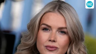 Karoline Leavitt lips: Experts weigh in on plastic surgery buzz; before-after pics go viral after Vanity Fair photo | Hindustan Times