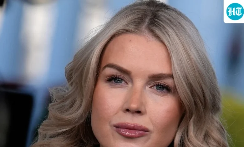 Karoline Leavitt lips: Experts weigh in on plastic surgery buzz; before-after pics go viral after Vanity Fair photo | Hindustan Times