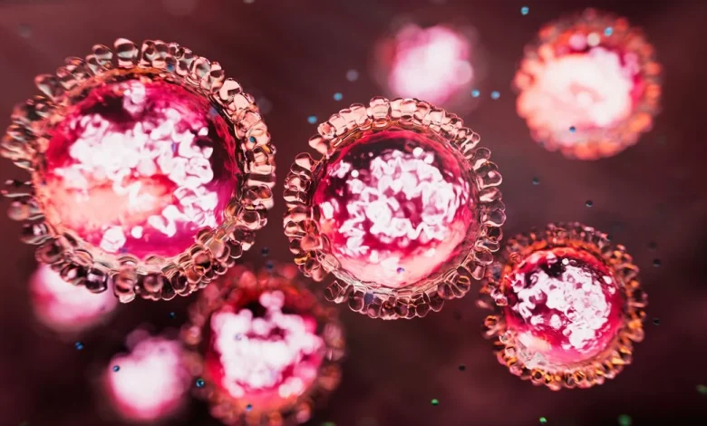 NSW Health issues measles alert for Sydney