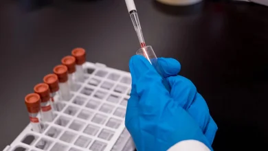 Tired of being tired? Scientists Develop Blood Test for Chronic Fatigue Syndrome