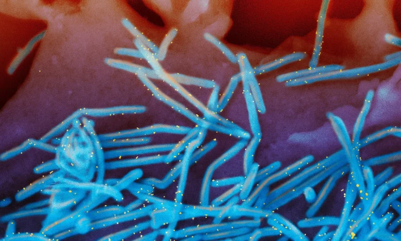 Winter virus season so far is not too bad, but doctors worry about suffering to come