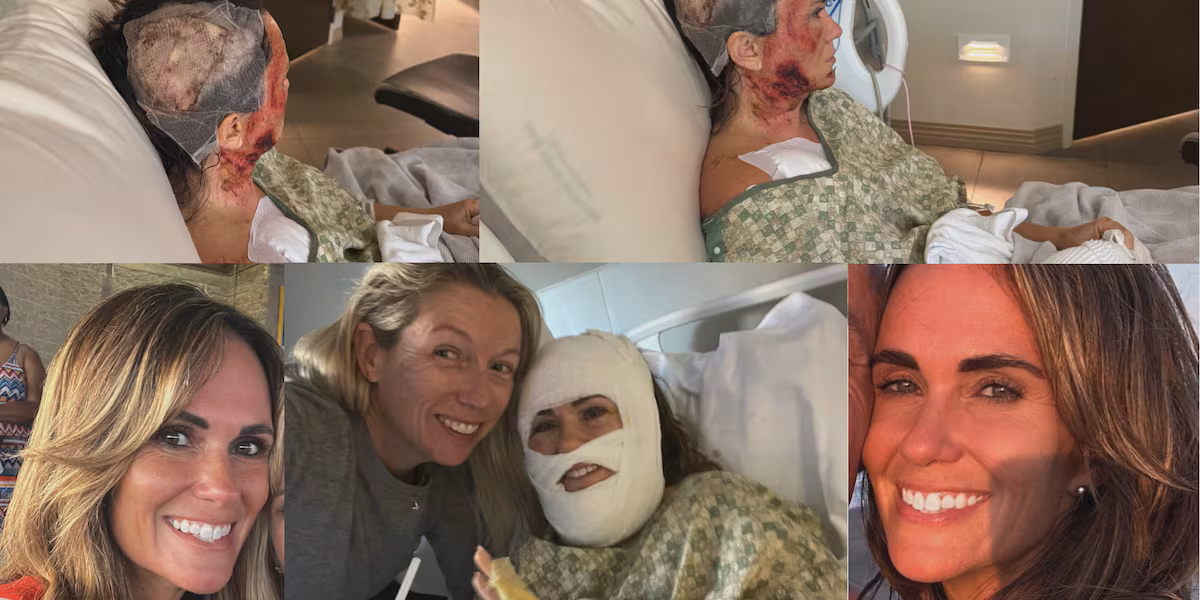Woman suffers severe burns in Forsyth Park acid attack; Community concerned